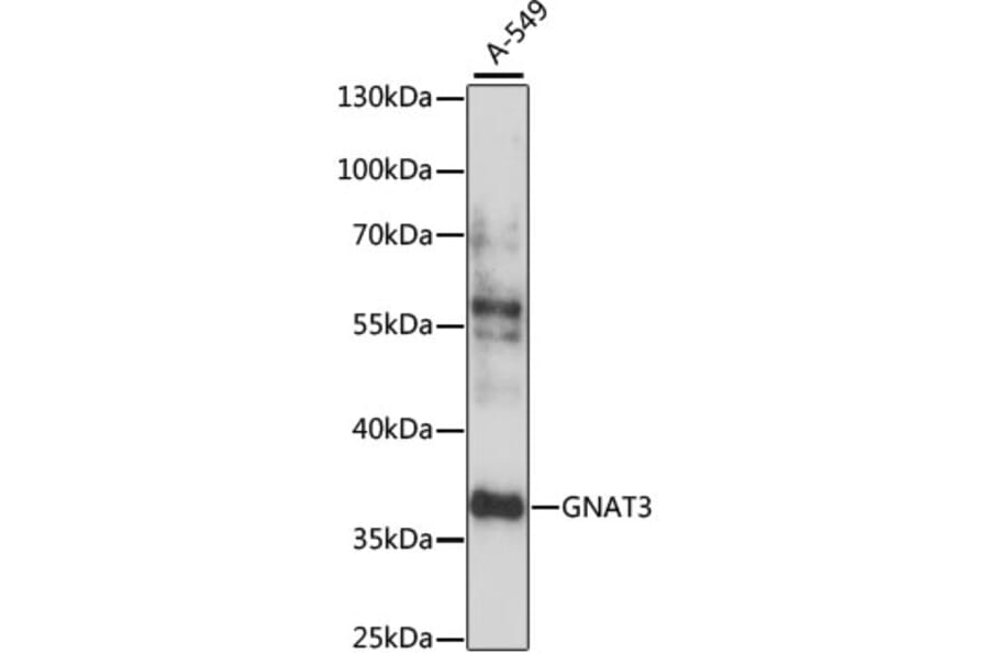 Western Blot - Anti-GNAT3 Antibody (A89576) - Antibodies.com