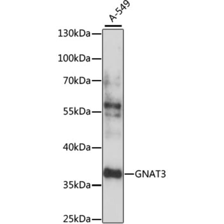 Western Blot - Anti-GNAT3 Antibody (A89576) - Antibodies.com