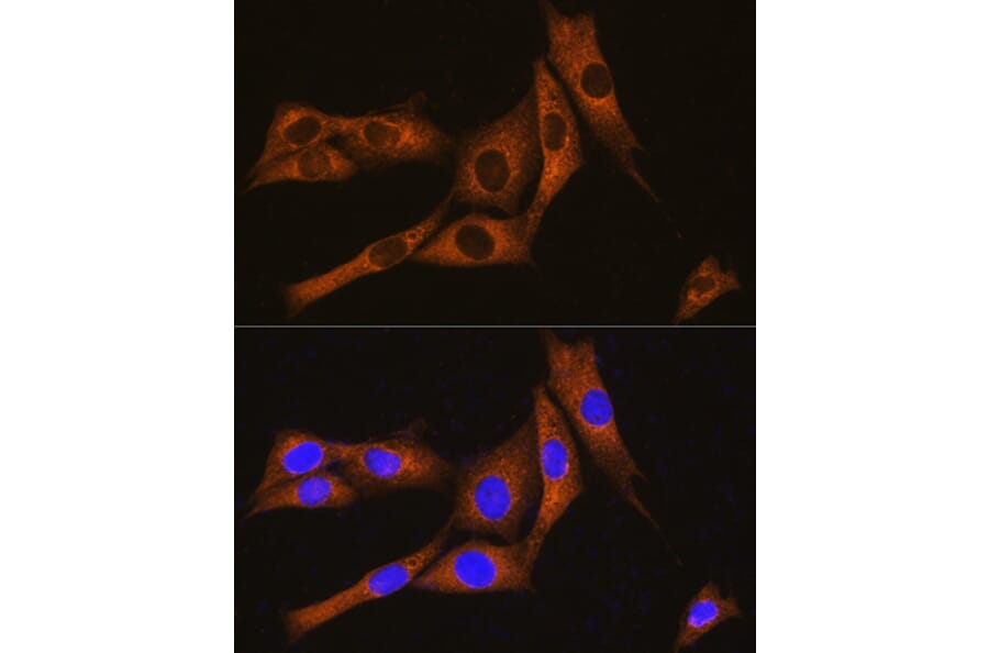 Immunofluorescence - Anti-GNAT3 Antibody (A89576) - Antibodies.com