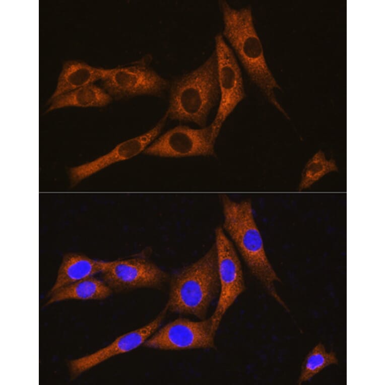 Immunofluorescence - Anti-GNAT3 Antibody (A89576) - Antibodies.com