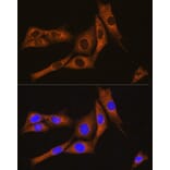 Immunofluorescence - Anti-GNAT3 Antibody (A89576) - Antibodies.com