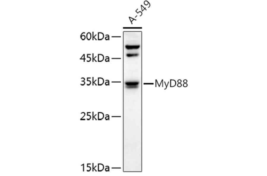 Western Blot - Anti-MyD88 Antibody (A89577) - Antibodies.com