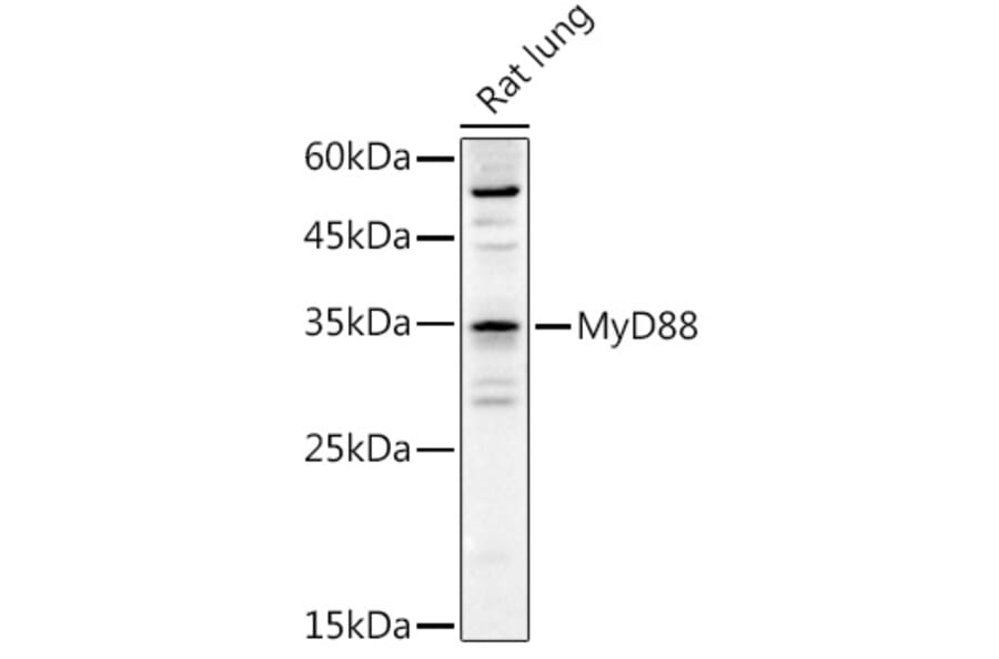 Western Blot - Anti-MyD88 Antibody (A89577) - Antibodies.com