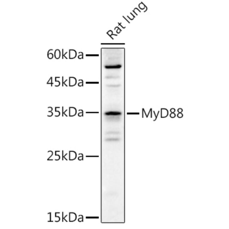 Western Blot - Anti-MyD88 Antibody (A89577) - Antibodies.com