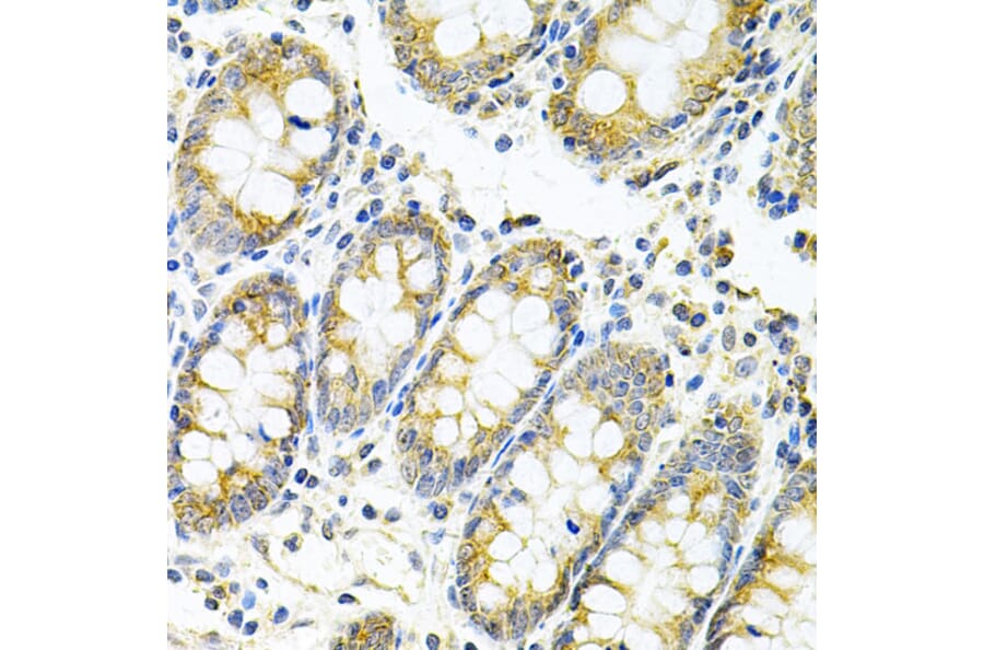 Immunohistochemistry - Anti-MyD88 Antibody (A89577) - Antibodies.com