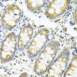 Immunohistochemistry - Anti-MyD88 Antibody (A89577) - Antibodies.com