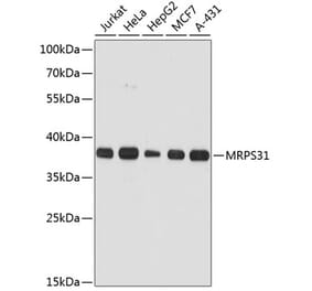 Western Blot - Anti-MRPS31 Antibody (A89578) - Antibodies.com