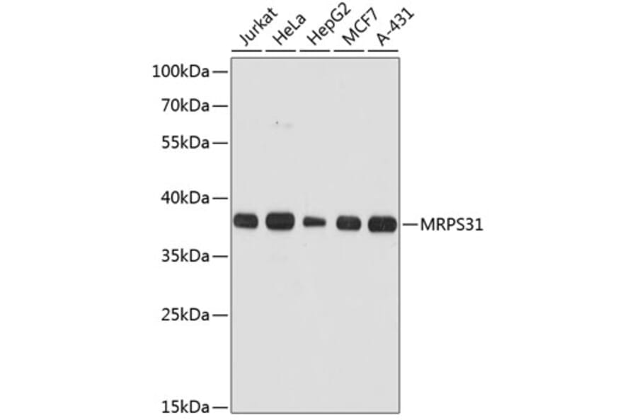 Western Blot - Anti-MRPS31 Antibody (A89578) - Antibodies.com