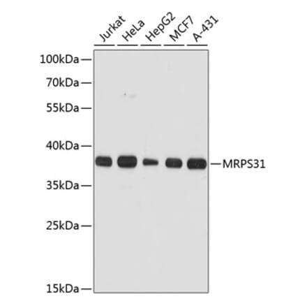 Western Blot - Anti-MRPS31 Antibody (A89578) - Antibodies.com