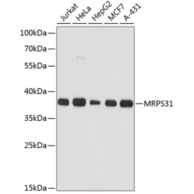 Western Blot - Anti-MRPS31 Antibody (A89578) - Antibodies.com