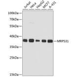 Western Blot - Anti-MRPS31 Antibody (A89578) - Antibodies.com