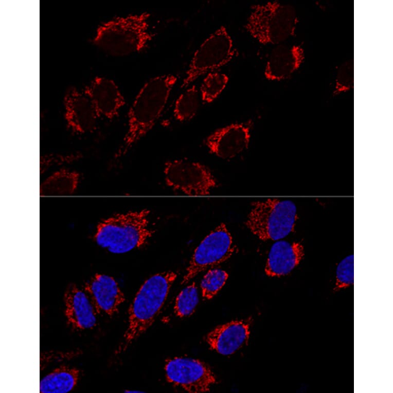 Immunofluorescence - Anti-MRPS31 Antibody (A89578) - Antibodies.com