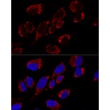 Immunofluorescence - Anti-MRPS31 Antibody (A89578) - Antibodies.com