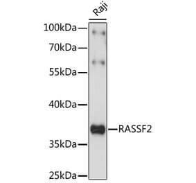 Western Blot - Anti-RASSF2 Antibody (A89579) - Antibodies.com