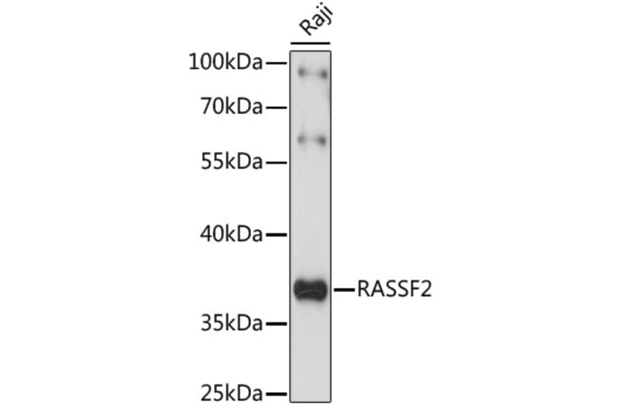 Western Blot - Anti-RASSF2 Antibody (A89579) - Antibodies.com