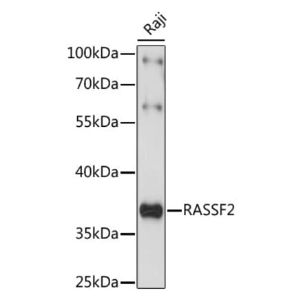 Western Blot - Anti-RASSF2 Antibody (A89579) - Antibodies.com