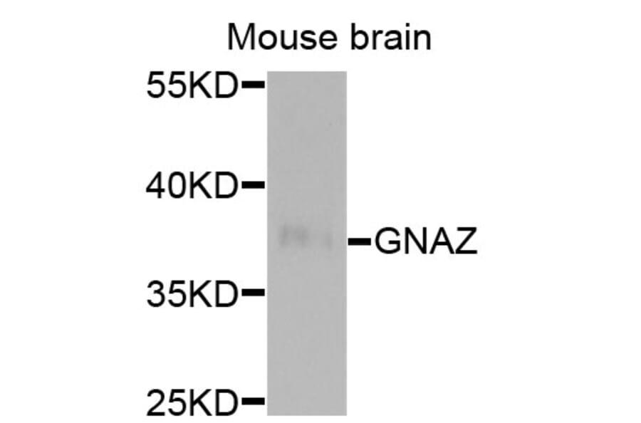 Western Blot - Anti-GNAZ Antibody (A13991) - Antibodies.com