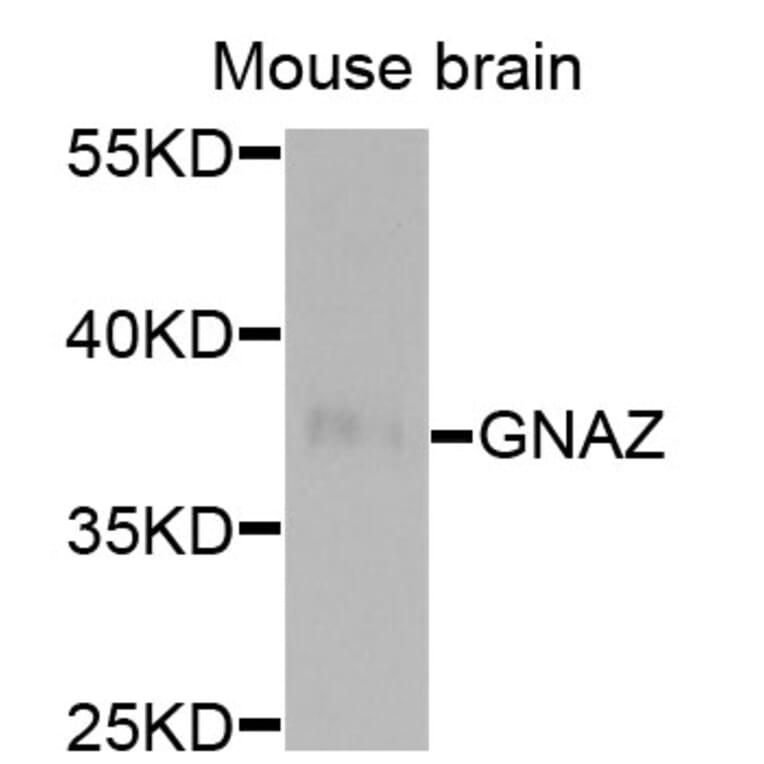 Western Blot - Anti-GNAZ Antibody (A13991) - Antibodies.com