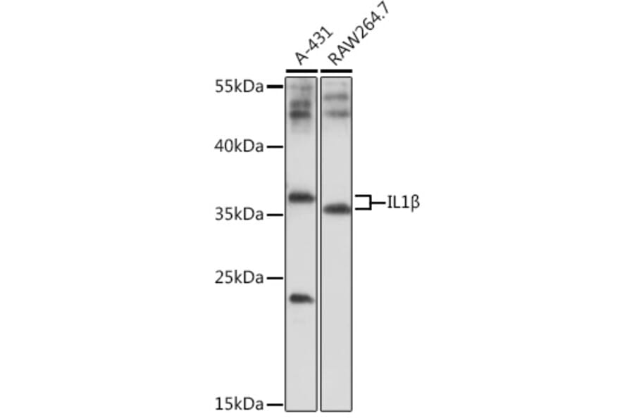 Western Blot - Anti-IL-1 beta Antibody (A89581) - Antibodies.com