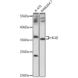 Western Blot - Anti-IL-1 beta Antibody (A89581) - Antibodies.com