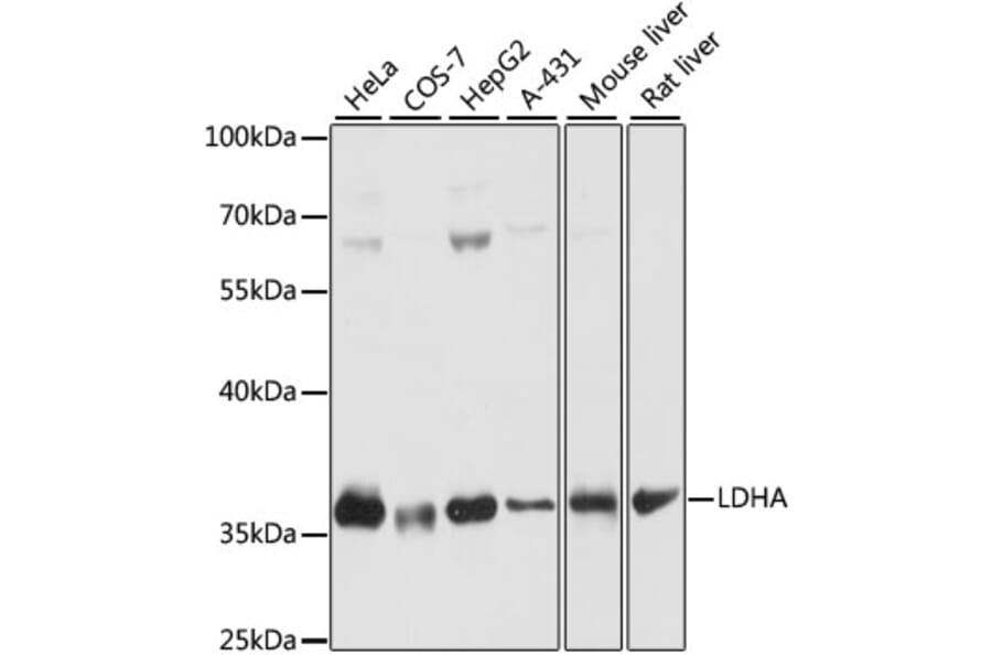Western Blot - Anti-Lactate Dehydrogenase Antibody (A89582) - Antibodies.com