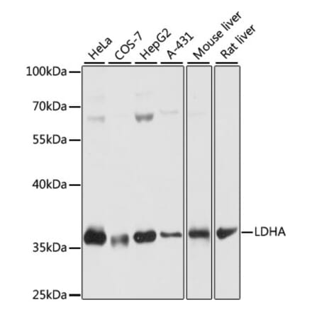 Western Blot - Anti-Lactate Dehydrogenase Antibody (A89582) - Antibodies.com