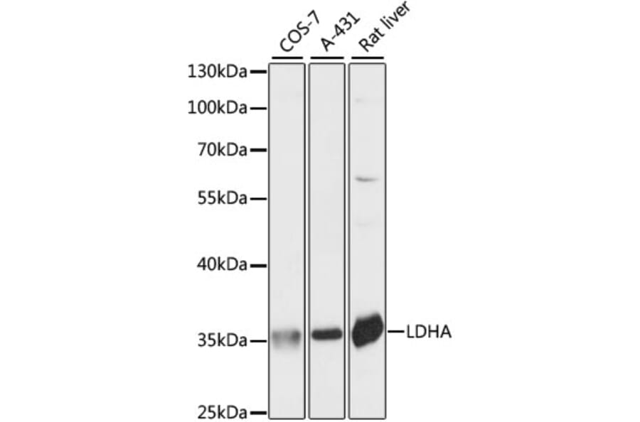 Western Blot - Anti-Lactate Dehydrogenase Antibody (A89582) - Antibodies.com