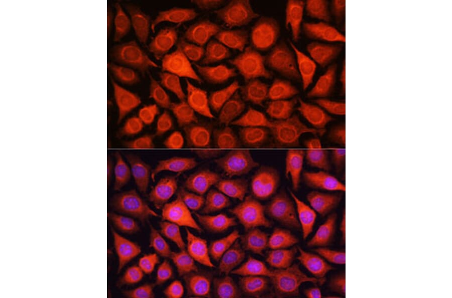 Immunofluorescence - Anti-Lactate Dehydrogenase Antibody (A89582) - Antibodies.com