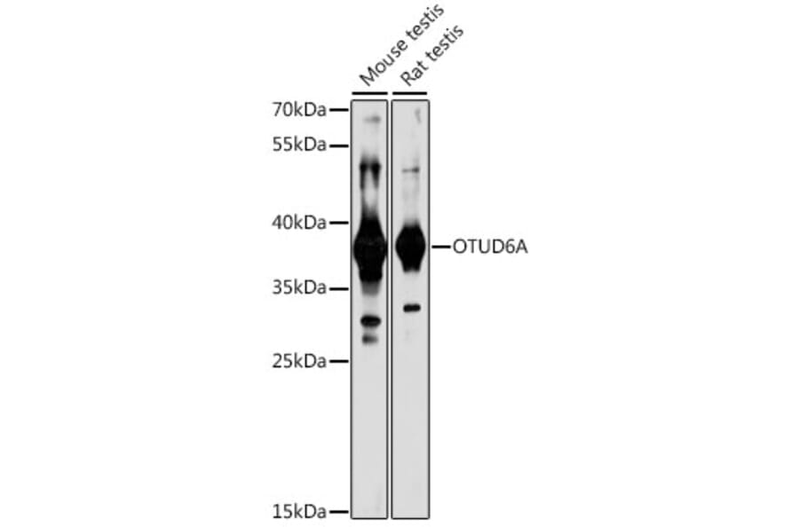 Western Blot - Anti-Otud6a Antibody (A89583) - Antibodies.com