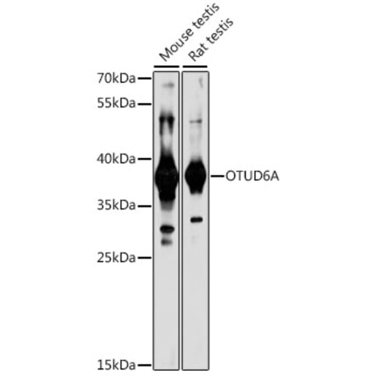 Western Blot - Anti-Otud6a Antibody (A89583) - Antibodies.com