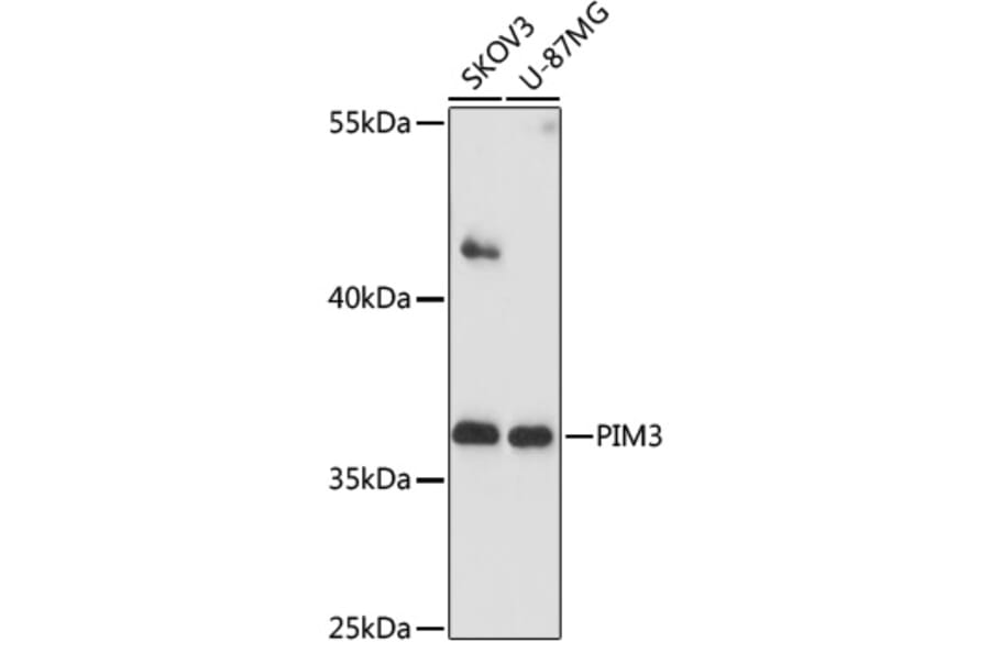 Western Blot - Anti-PIM3 Antibody (A89584) - Antibodies.com