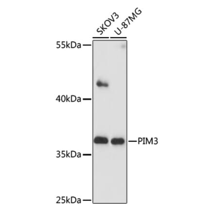 Western Blot - Anti-PIM3 Antibody (A89584) - Antibodies.com