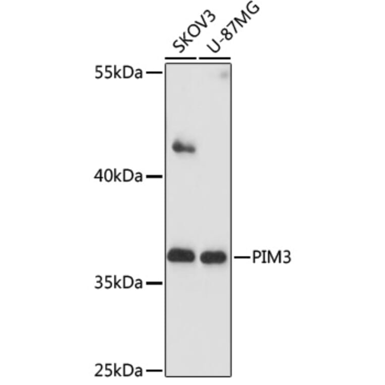 Western Blot - Anti-PIM3 Antibody (A89584) - Antibodies.com