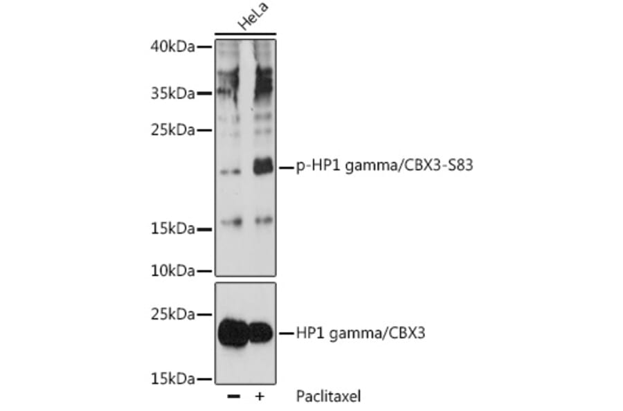 Western Blot - Anti-HP1 gamma/CBX3 (phospho Ser83) Antibody (A89585) - Antibodies.com