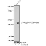 Western Blot - Anti-HP1 gamma/CBX3 (phospho Ser83) Antibody (A89585) - Antibodies.com