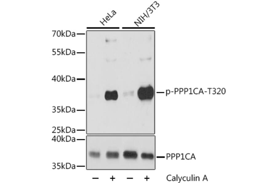 Western Blot - Anti-PPP1A/PPP1CA (phospho Thr320) Antibody (A89586) - Antibodies.com