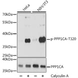 Western Blot - Anti-PPP1A/PPP1CA (phospho Thr320) Antibody (A89586) - Antibodies.com