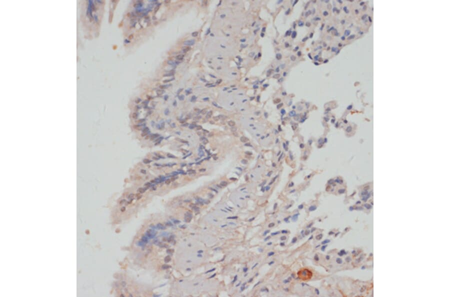 Immunohistochemistry - Anti-PPP1A/PPP1CA (phospho Thr320) Antibody (A89586) - Antibodies.com