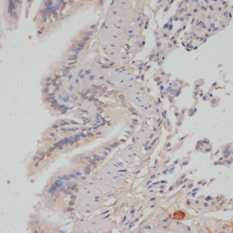 Immunohistochemistry - Anti-PPP1A/PPP1CA (phospho Thr320) Antibody (A89586) - Antibodies.com