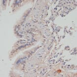 Immunohistochemistry - Anti-PPP1A/PPP1CA (phospho Thr320) Antibody (A89586) - Antibodies.com