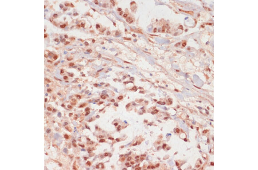 Immunohistochemistry - Anti-PPP1A/PPP1CA (phospho Thr320) Antibody (A89586) - Antibodies.com