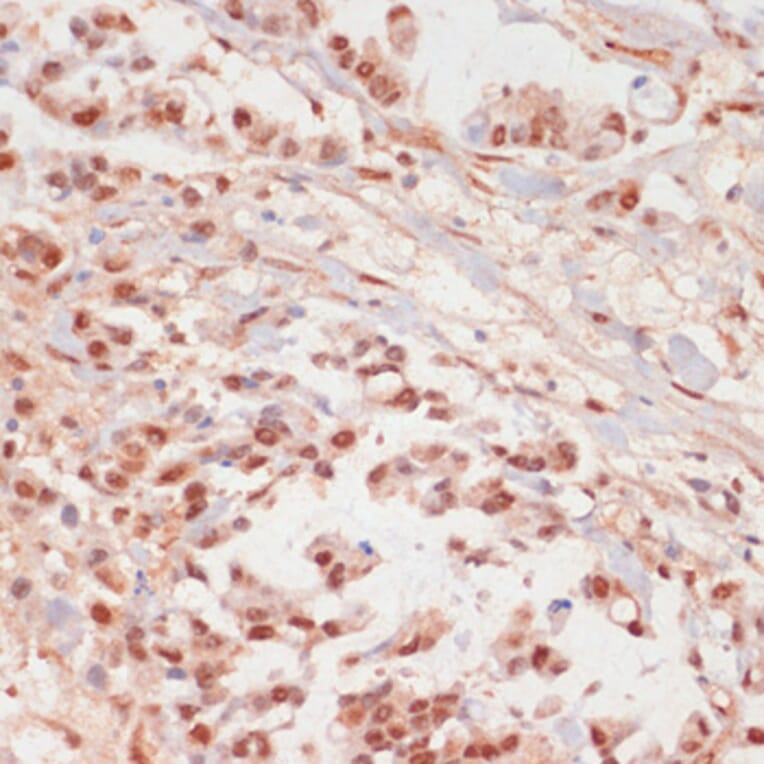 Immunohistochemistry - Anti-PPP1A/PPP1CA (phospho Thr320) Antibody (A89586) - Antibodies.com