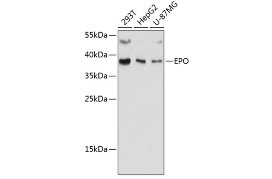 Western Blot - Anti-EPO Antibody (A89587) - Antibodies.com