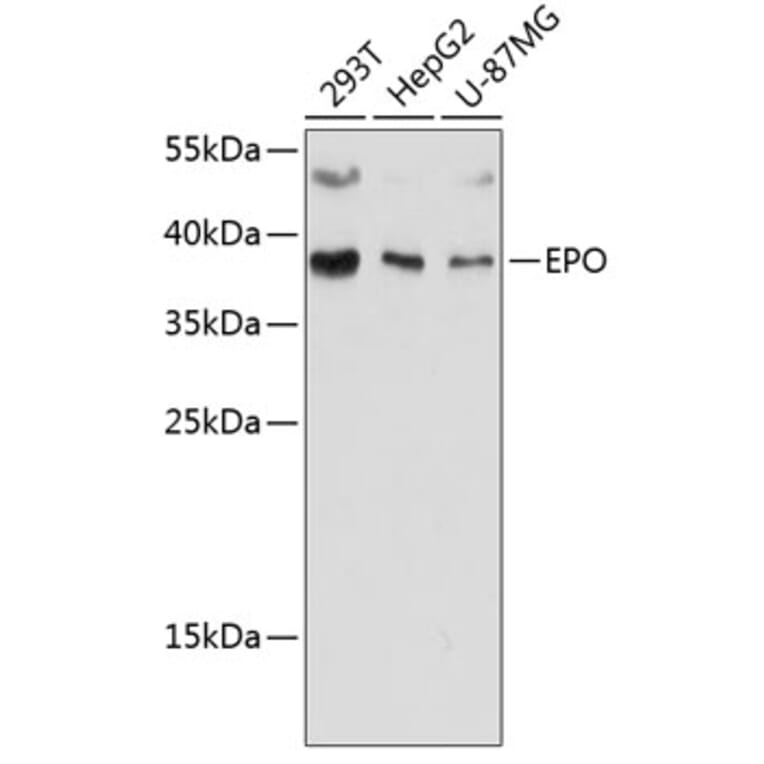 Western Blot - Anti-EPO Antibody (A89587) - Antibodies.com
