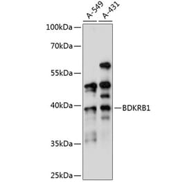 Western Blot - Anti-B1R Antibody (A89588) - Antibodies.com