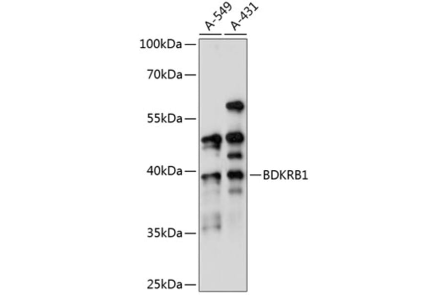 Western Blot - Anti-B1R Antibody (A89588) - Antibodies.com