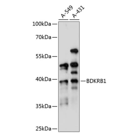 Western Blot - Anti-B1R Antibody (A89588) - Antibodies.com