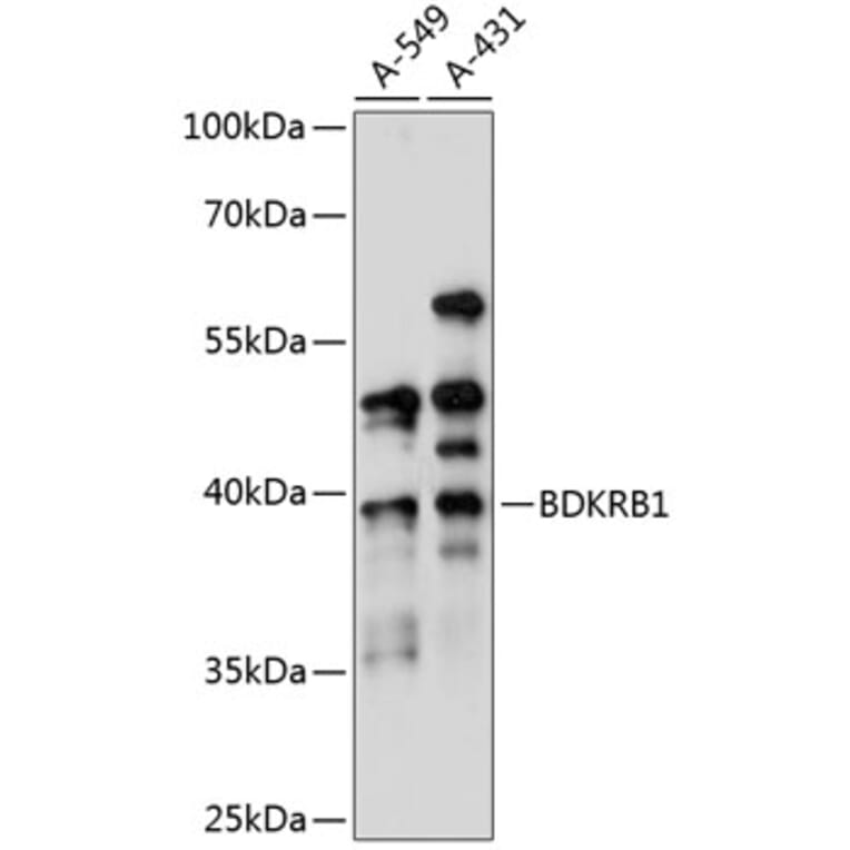 Western Blot - Anti-B1R Antibody (A89588) - Antibodies.com
