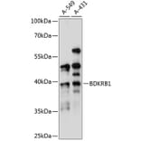 Western Blot - Anti-B1R Antibody (A89588) - Antibodies.com