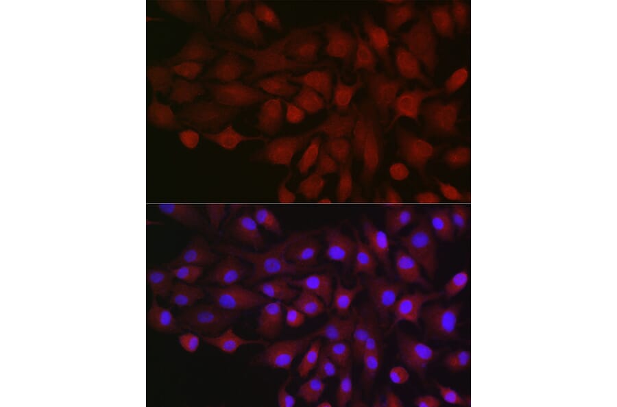 Immunofluorescence - Anti-B1R Antibody (A89588) - Antibodies.com